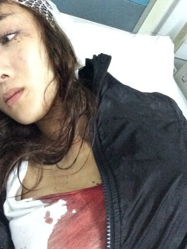 李依晓整容前后照片 李依晓的胸 李依晓老公照片